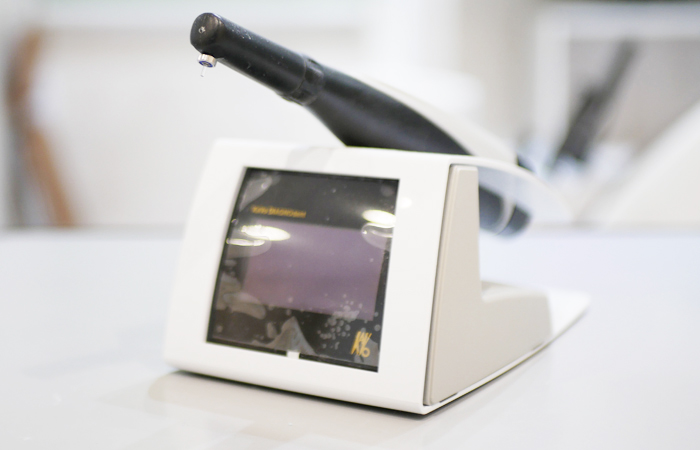 ダイアグノデント