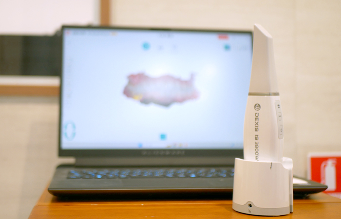 3D光学スキャナー