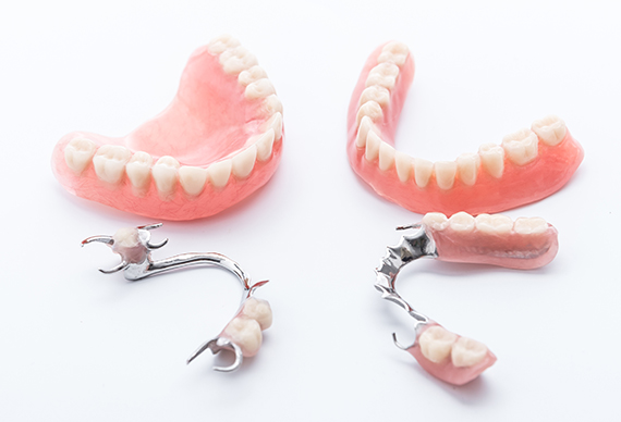 入れ歯（義歯）