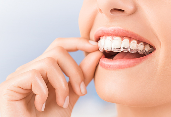 矯正歯科・小児矯正歯科